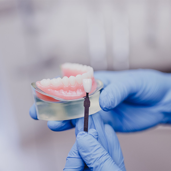 dentist holding a model of a dental implant